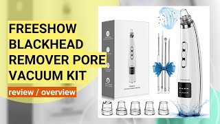 FREESHOW Blackhead Remover Review Does This Pore Vacuum Really Work [upl. by Nuhsar]