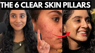 How I Would Clear Acne in 2024 6STEP BLUEPRINT [upl. by Orecul]