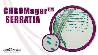 New Chromogenic Media for detection of Serratia marcescens CHROMagar Serratia [upl. by Haines]