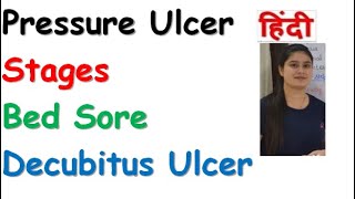 Pressure Ulcer  Stages of Pressure Ulcer  Bed Sores  Decubitus Ulcer  RajNEET Medical Education [upl. by Soo]