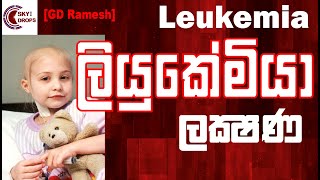 Leukemia Symptoms GD Ramesh Sinhala [upl. by Katzir]