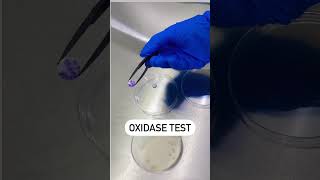 Oxidase Reaction Test  Disc Oxidase Test  Positive Oxidase Reaction microbiology youtubeshorts [upl. by Ojoj]