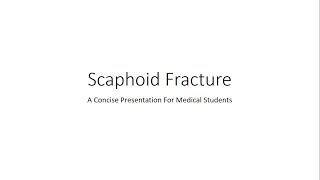 Scaphoid Fracture  Orthopedics for Medical Students [upl. by Janaya]