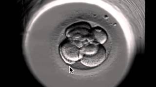 ivf embryo developing over 5 days by fertility Dr Raewyn Teirney [upl. by Grados]