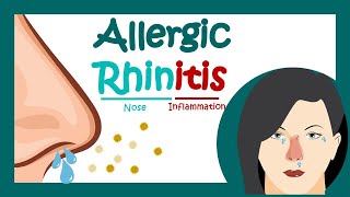 Allergic rhinitis  What is Allergic Rhinitis  What is the main cause of allergic rhinitis [upl. by Kai]