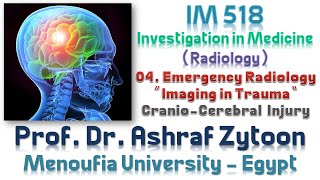 04 Undergraduate Medical Imaging and Radiology Fundamentals  CranioCerebral Injury [upl. by Idnahc]