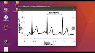 EKG RR Intervalleri ve Kalp Atım Hızı  Matlab  Ders 5 [upl. by Keelby938]