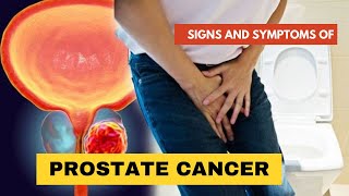 SIGNS AND SYMPTOMS OF PROSTATE CANCER [upl. by Ynaffi]