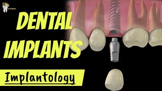 DENTAL IMPLANTS  INTRO and ADVANTAGES OSSEOINTEGRATION EXPLAINED [upl. by Juster]