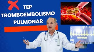 TEP Embolia Pulmonar  Aprenda tudo sobre Tromboembolismo Pulmonar [upl. by Tennaj324]