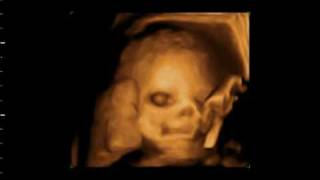 Video of BabyPlus Prenatal Education infant opening eyes in womb [upl. by Emelyne686]