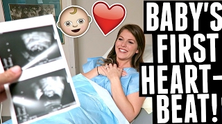 11 week Ultrasound We Hear Babys Heartbeat for the First Time [upl. by Emrich29]