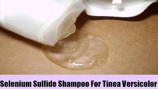 7 Home Remedies For Tinea Versicolor [upl. by Abbotsen]