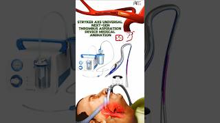 Stryker AXS Universal NextGen Thrombus Aspiration Device Medical Animation 3d short [upl. by Navi]