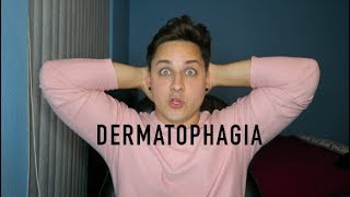 Living with Dermatophagia Skin biting disorder [upl. by Aurora]