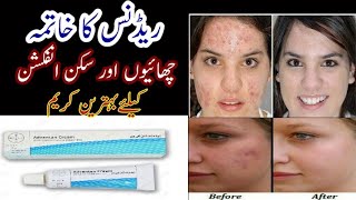 Uses Of Advantan CreamFacial Rashes Mukammal KhatamIjaz Pharmacist [upl. by Bhatt805]