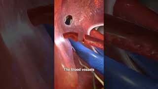 How to liver transplant 😲😨😲 youtubeshorts facts animation animationmovieexplained medical [upl. by Attenor]