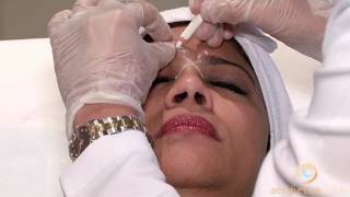 Botulinum Toxin Injections Short introductory tutorial [upl. by Sicnarf]