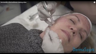 Dermaroller  eDermastamp training video [upl. by Westphal]