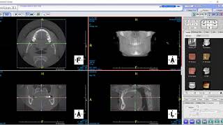 PreXion Training Tips Slicing images utilizing crossbars and toolbar functions [upl. by Irrek38]