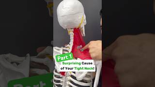 Part 12 Is your neck tight with shoulder blade or arm pain Try this neckpain shoulderpain tmj [upl. by Nainatrad]