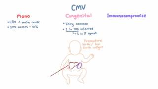 CMV Clinical Syndromes  Mono Congenital Infection Immunocompromised Hosts [upl. by Odla16]