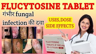 Flucytosine capsule uses in hindi  Flucytosine in hindi  flucytosine [upl. by Ronaele]