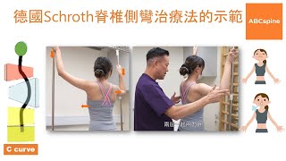 物理治療師  鄭進成 Aldous 示範德國Schroth脊椎側彎治療法單胸彎 [upl. by Nihcas]