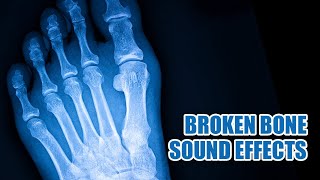 Bone Breaking Sound Effect 🦴 Bone Snapping Sounds [upl. by Irena179]