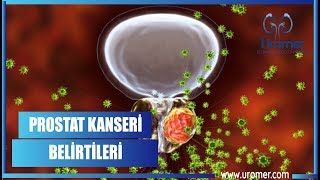 PROSTAT KANSERİ BELİRTİLERİ [upl. by Cassandry185]