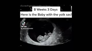 8 weeks and 3 days pregnancy ultrasound [upl. by Novak]