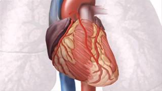 O que é a cirurgia de pontagem bypass coronária [upl. by Ilise]