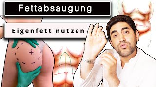 Unglaublich Fettabsaugung und das Fett nutzen  Lipofilling  Dr Alawi [upl. by Itsur]