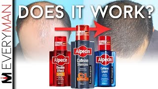 DOES CAFFEINE SHAMPOO WORK  Alpecin REVIEW amp Hair Growth Alternatives [upl. by Helve558]