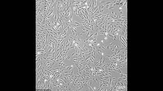 How quick do these melanoma cells grow [upl. by Rimidalv]