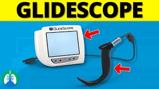 What is GlideScope Intubation [upl. by Nyraf]