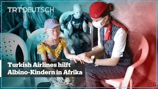 Turkish Airlines hilft AlbinoKindern in Afrika [upl. by Suoirred436]