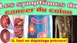 Cancer du Côlon cancer colorectal Détectez les Premiers Symptômes Qui Peuvent Sauver des Vies [upl. by Jonathon]