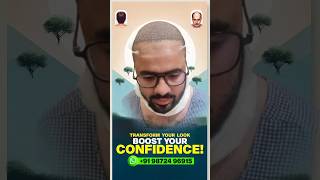 Best Hair Transplant clinic  How to stop Hairfall hair hairtransplant newvideo youtubeshorts [upl. by Whatley]