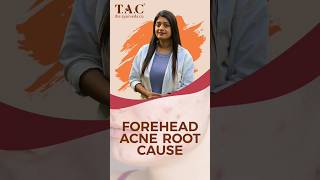 Reasons for Forehead Acne  Acne [upl. by Wolfort]