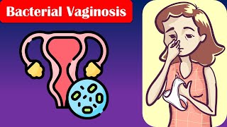 Bacterial Vaginosis  Causes Risk Factors Signs amp Symptoms Diagnosis And Treatment [upl. by Ssilb420]