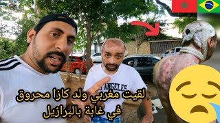 تلاقيت مغربي ولد كازا محروق في أخطر غابة في البرازيل تبكي 😱🇧🇷🇲🇦 azdine boumani vlogs [upl. by Aicarg326]