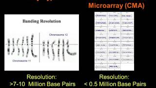 The Importance of Microdeletions [upl. by Wilfreda397]