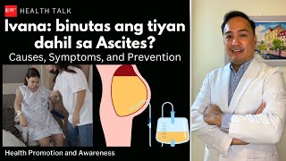 Bakit binutas ang tiyan ni Ivana Ascites Causes Symptoms and Prevention [upl. by Ramas]