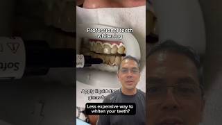 A LESS EXPENSIVE Way to Whiten Your Teeth FAST Hydrogen Peroxide  View Mobile Dental shorts [upl. by Oguh]