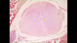 Interneuron sensory neuron pseudounipolar neuron ependymal cells satellite cells Spinal cord amp g [upl. by Akemeuwkuhc]