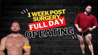 I HAD GYNECOMASTIA SURGERY Gyno removal  1 Week Post Op  Full Day Of Eating  Leg Day [upl. by Pejsach]