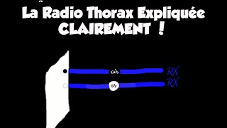 🔴 Dr Astuce  1 LA RADIO THORAX EXPLIQUÉE CLAIREMENT [upl. by Tshombe]