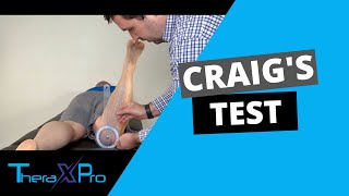 Craigs Test  Femoral Anteversion  Femoral Retroversion [upl. by Olgnaed918]