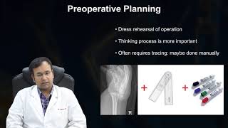 3D Printing and its Role in Orthopedic by Dr Bhavuk Garg  Omnicuris [upl. by Adnahc914]